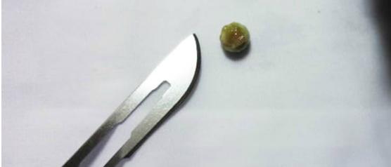 帮乌龟处理疥疮全过程,乌龟长疥疮了怎么治疗