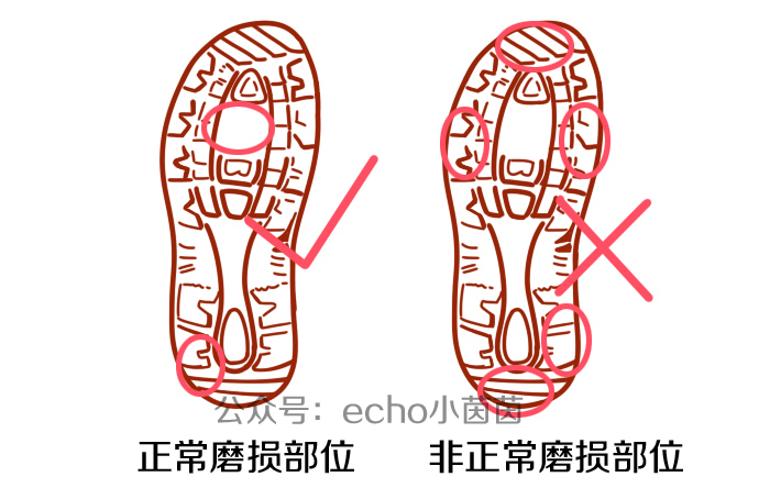 宝宝磨鞋底是什么原因,宝宝鞋底哪边磨最好