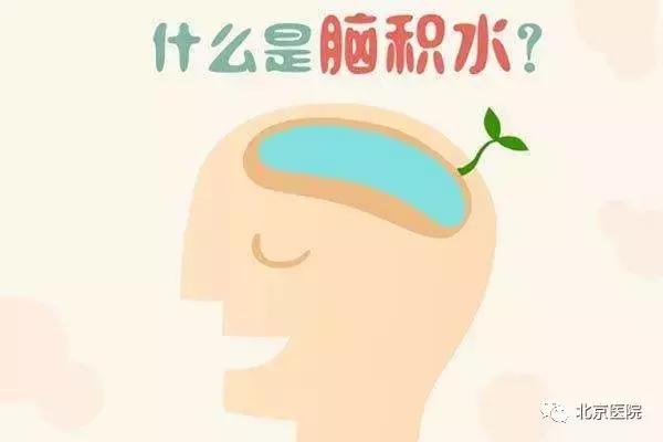 北京儿童医院神经外科脑积水,北京宣武医院神经外科脑积水