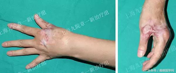 体会光的魔力，唤醒你的肌肤（很干的干货）