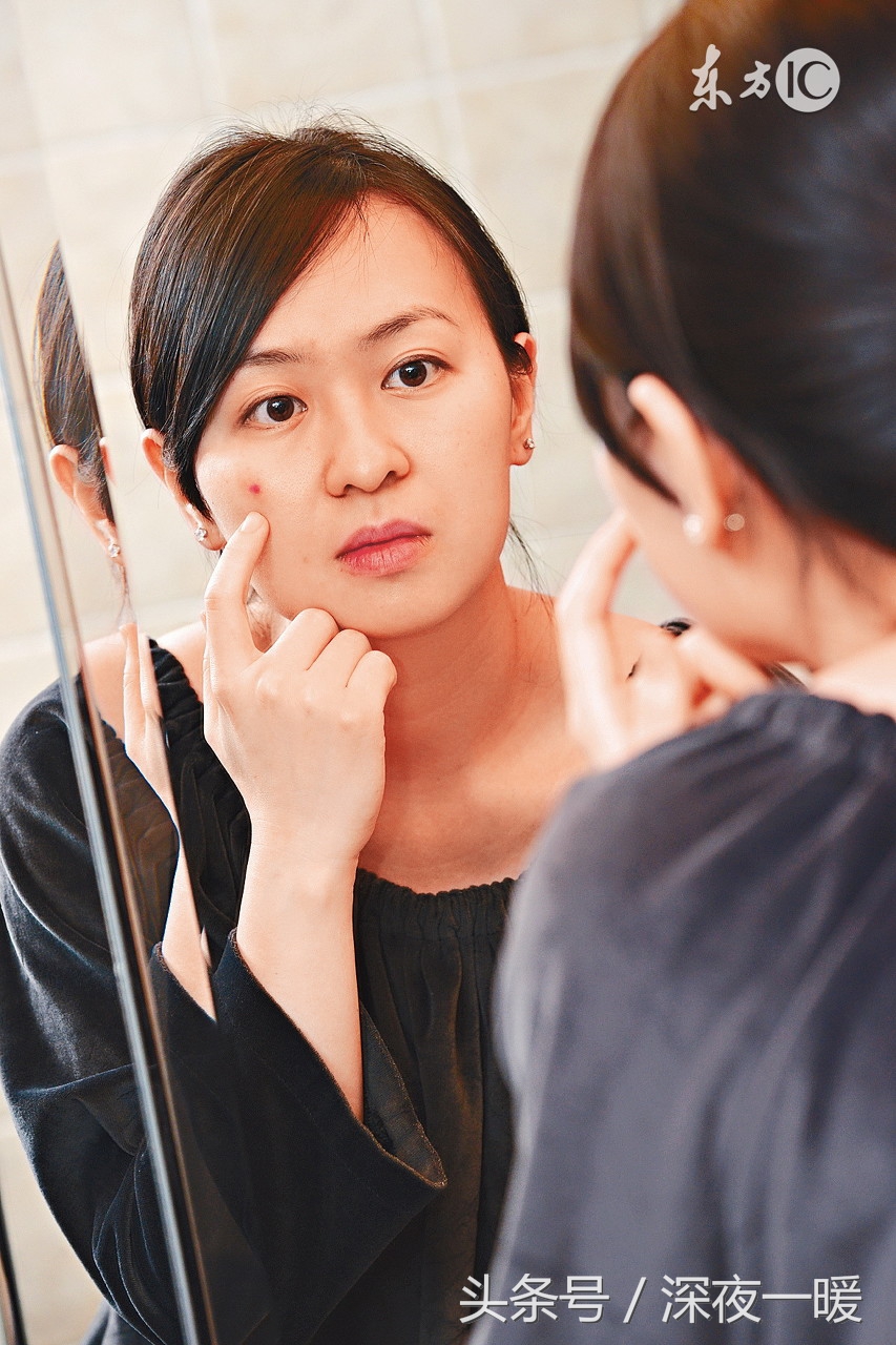 祛痘方法有哪些怎么祛痘最有效,祛痘怎么这么难啊