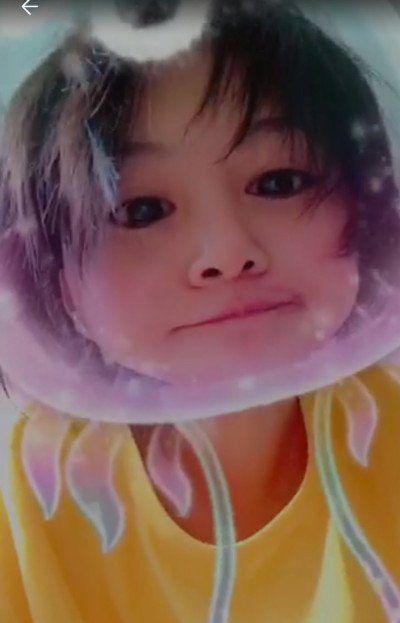 郑爽压力大深夜失眠嘴角上火，早晨起床头发凌乱不忘卖萌放飞自我