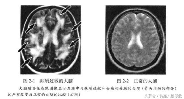 荐书：《谷物大脑》哗众取宠，还是真知灼见？你怎么看？
