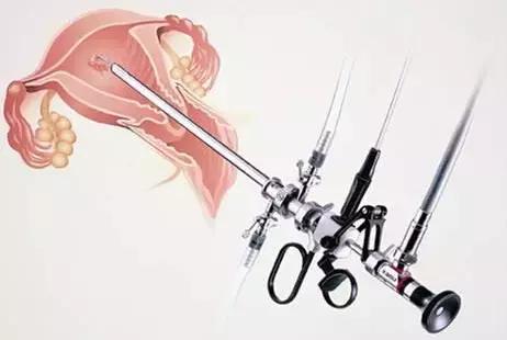 关于宫腔镜，准妈妈应该知晓的二三事