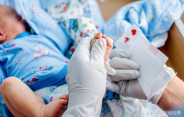 pku苯丙酮尿症症状,pku苯丙酮尿症是天生有的吗