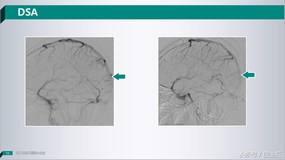 各项检查都正常为啥老是心慌,各项检查都正常为啥还是头晕