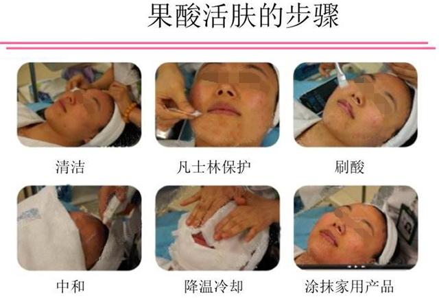 ordinary30%果酸脸上有痘痘可以用吗,果酸对脸上的痘有用吗
