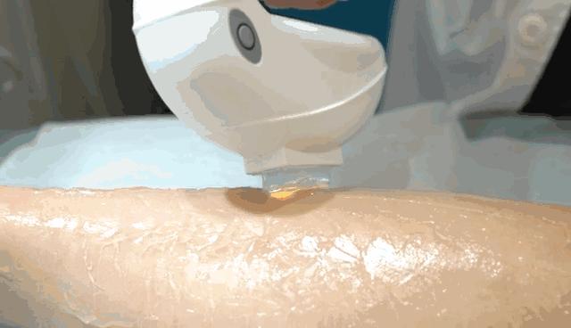 露腿最佳的季节,露腿季节来了