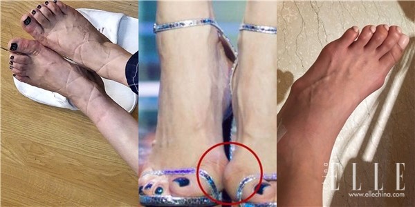 扁平足凉鞋推荐,好看脚感又好的凉鞋