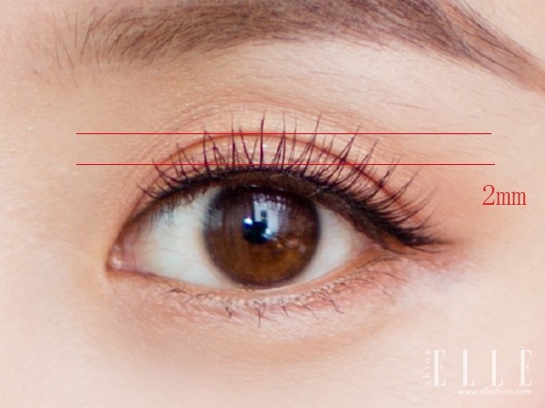 双眼皮100种整形图解,双眼皮整形全程讲解