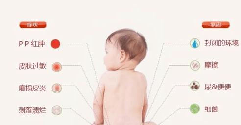 天天兜尿不湿宝宝红屁股了,该怎么办?