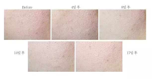 花500元买护肤品值得吗,想买一套500多的护肤品舍不得