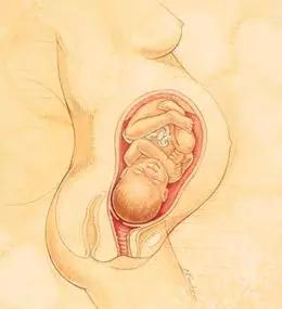 金牌助产士分娩,自然分娩过程助产士