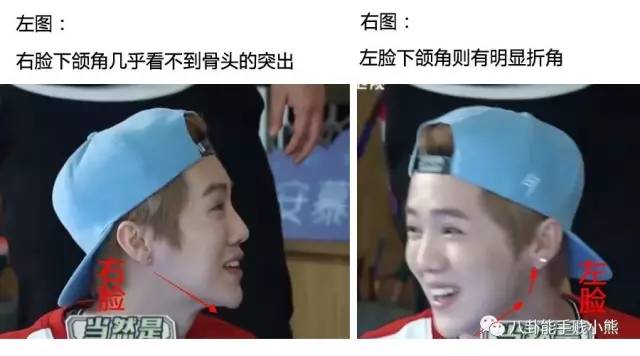 周冬雨鹿晗黄子韬的同款不对称下颌角，值得拥有吗？
