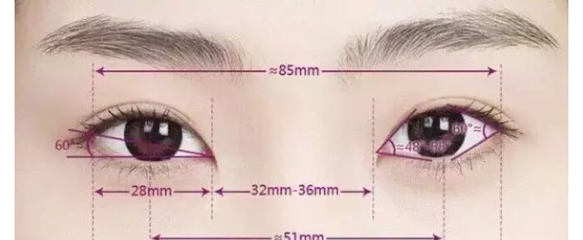 和阿姨的双眼皮做的太宽失败了