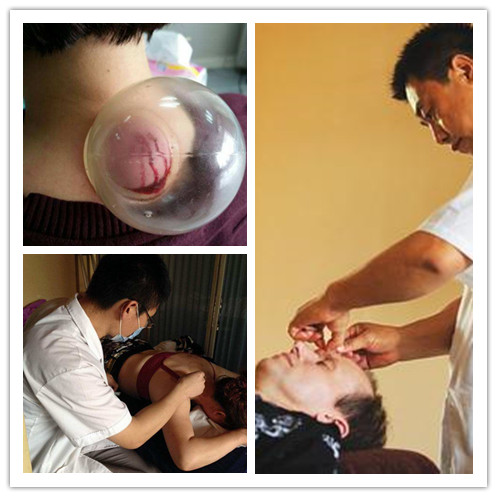 治疗各种头痛的口诀,治头痛的10首验方