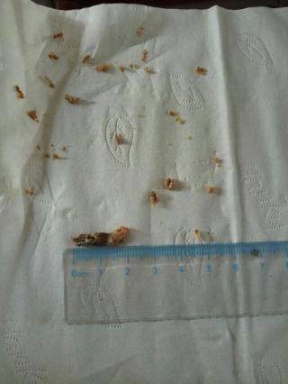 怎样才能挖到这么大块耳屎?恶心!但看着好爽啊!