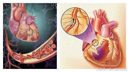 临床心血管内科常用药总结,心血管内科输液的常用药物及作用