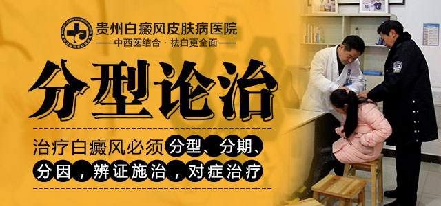 白癜风诊断及鉴别诊断,白癜风的鉴别与诊断