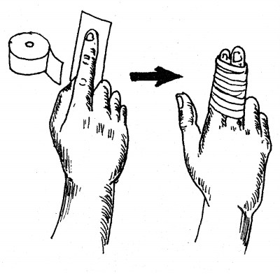 小儿急救常识高清,儿童急救常识100个小知识
