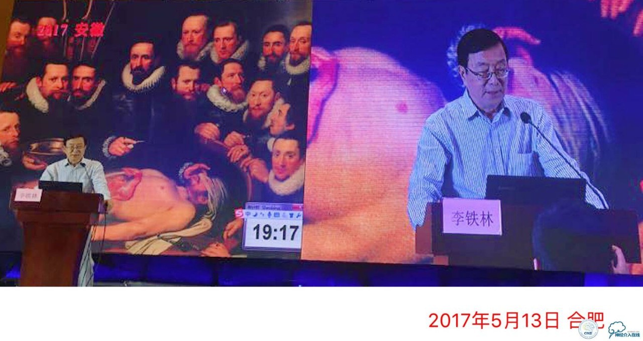 神经介入操作要点,李铁正确训练方法