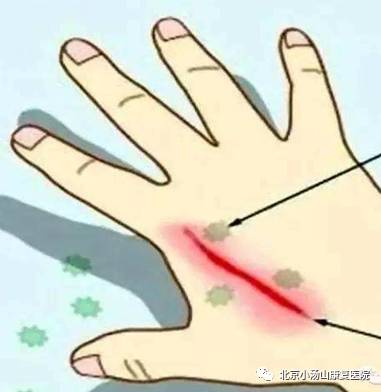 「科普专栏」皮肤病康复科普系列之——红蓝光治疗仪