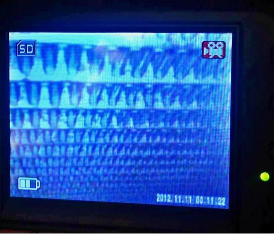 怎么自己动手清洗汽车空调蒸发箱,空调管路杀菌和蒸发箱清洗的区别