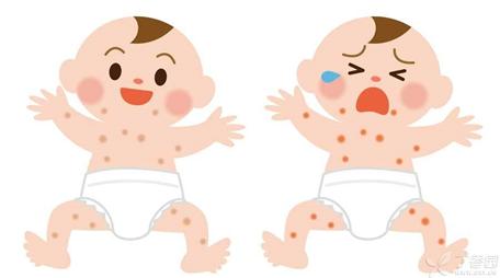 宝宝湿疹怎么治疗好得最快最有效,宝宝反复湿疹对付湿疹有妙招