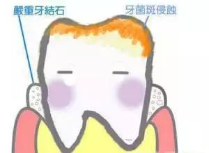 拥有一口好牙才能算的上完美，终极美白牙齿的攻略在这里！