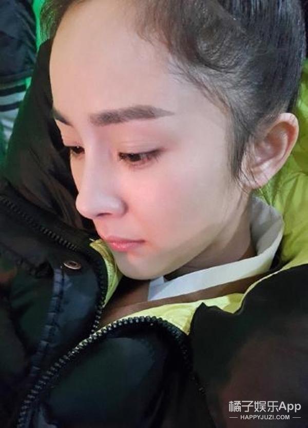 法令纹显老明星,明星怎么治法令纹