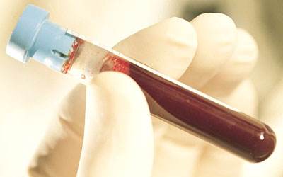 高脂血症治疗的新型药物,高脂血症什么情况下药物治疗