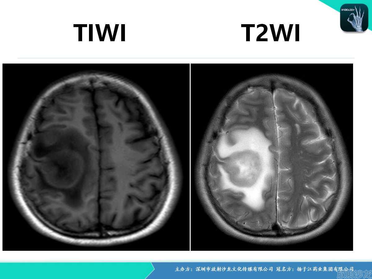 图王争霸赛,图钉拳王争霸赛2011