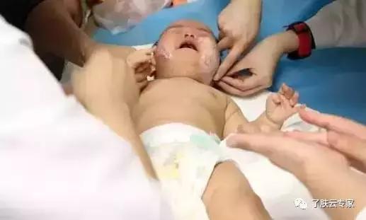 儿童皮肤病防治知识大全,儿童皮肤科护理流程