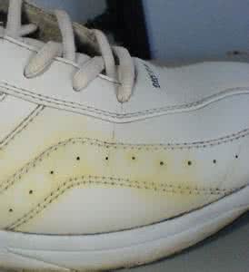 白鞋子发黄洗白小窍门直播,网面白鞋子发黄洗白小窍门