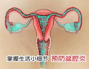 盆腔炎性疾病要怎样治疗,盆腔炎性疾病的正确治疗方法