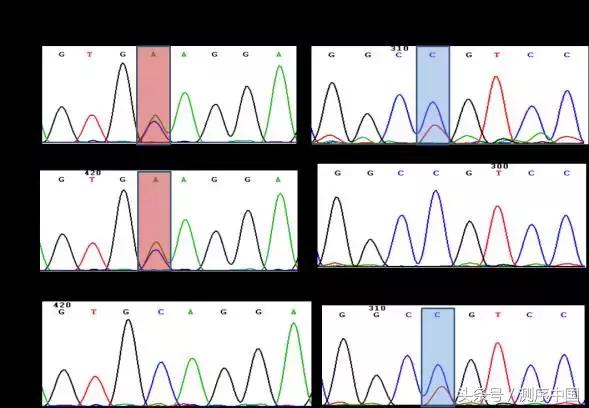 余永国儿科学博士,余永国教授