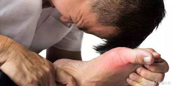 痛风本身不致命是怎么回事,痛风不是很严重应该吃什么药