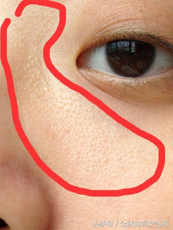 扫“黄”9步曲告诉你：“一月内美白”选对产品才是关键！