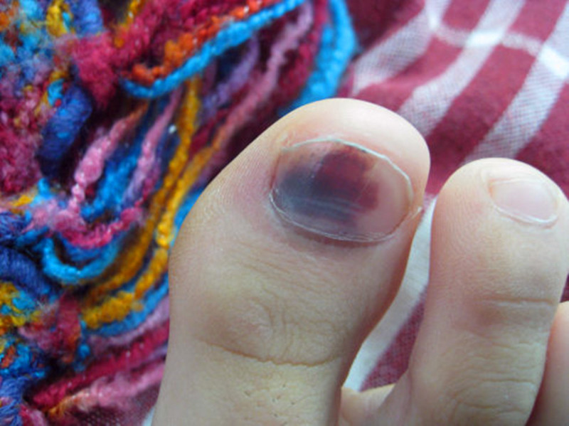 要怎么做才能让宝宝远离危险,宝宝为什么容易得甲沟炎