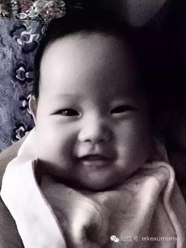 黄皮肤？黄疸？妈妈傻傻分不清楚？