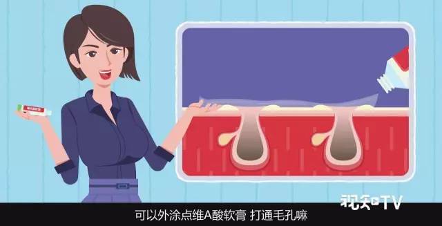 想去黑头收缩毛孔用什么成分,去黑头缩毛孔产品推荐微晶导入