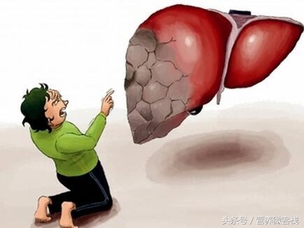 肝豆状核变性有什么症状,肝豆状核变性能吃山药吗