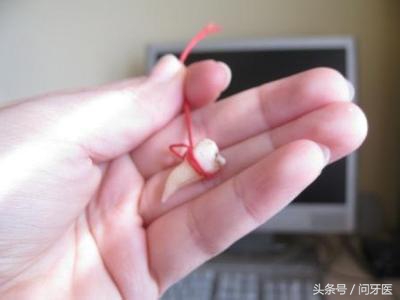 拔牙后出血不止怎么处理,服用抗凝药拔牙出血不止怎么处理