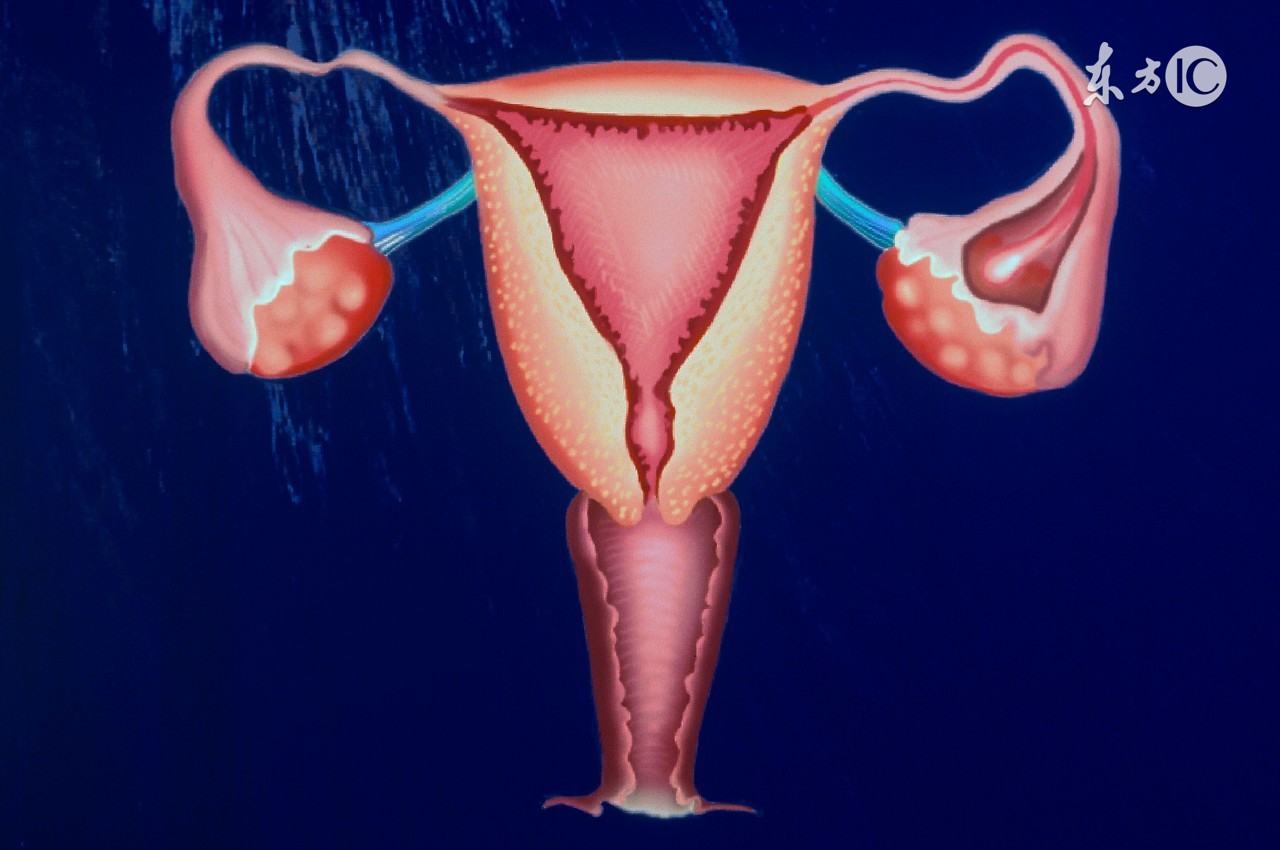 妇科宫颈糜烂怎样能治好,宫颈糜烂不是病不需要治疗不用管