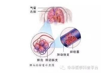 输血的不良反应讲课,输血不良反应警示教育