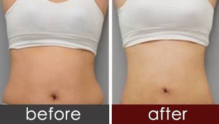 瘦腰腹赘肉的方法,瘦腰腹和肚子的最好方法