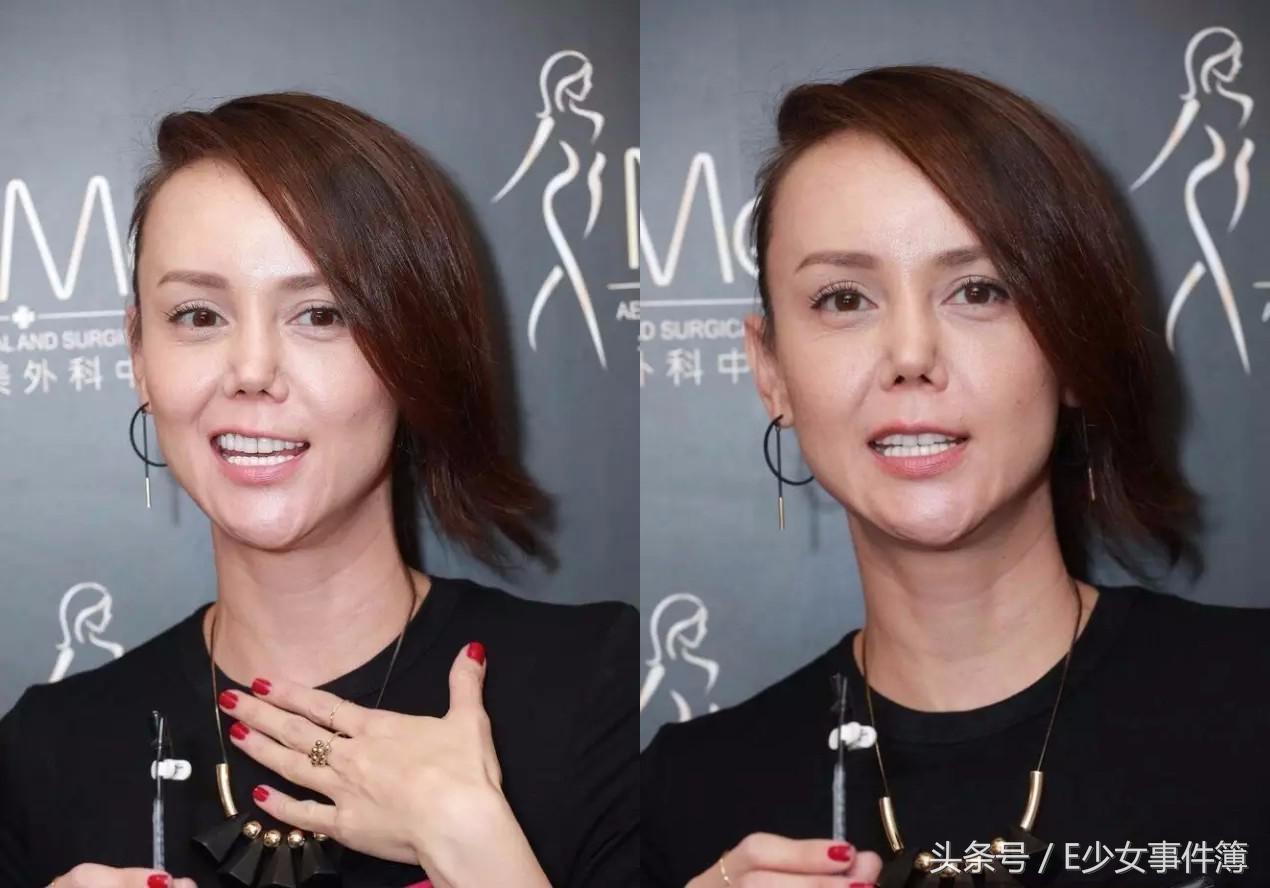 韩君婷厌食症,最美亚姐结局