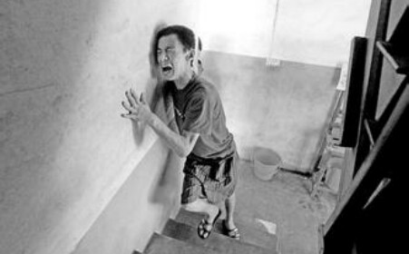 眼肌重症肌无力怎么治疗,重症肌无力治疗要多少钱