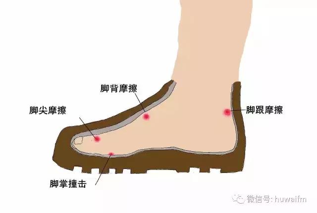 新鞋磨脚磨出水泡,新鞋磨脚破了怎么办