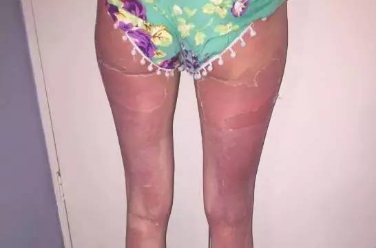 去西北旅游防晒乳推荐哪款好,进藏防晒有用吗